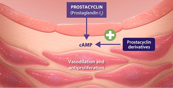 Prostacyclin pathway